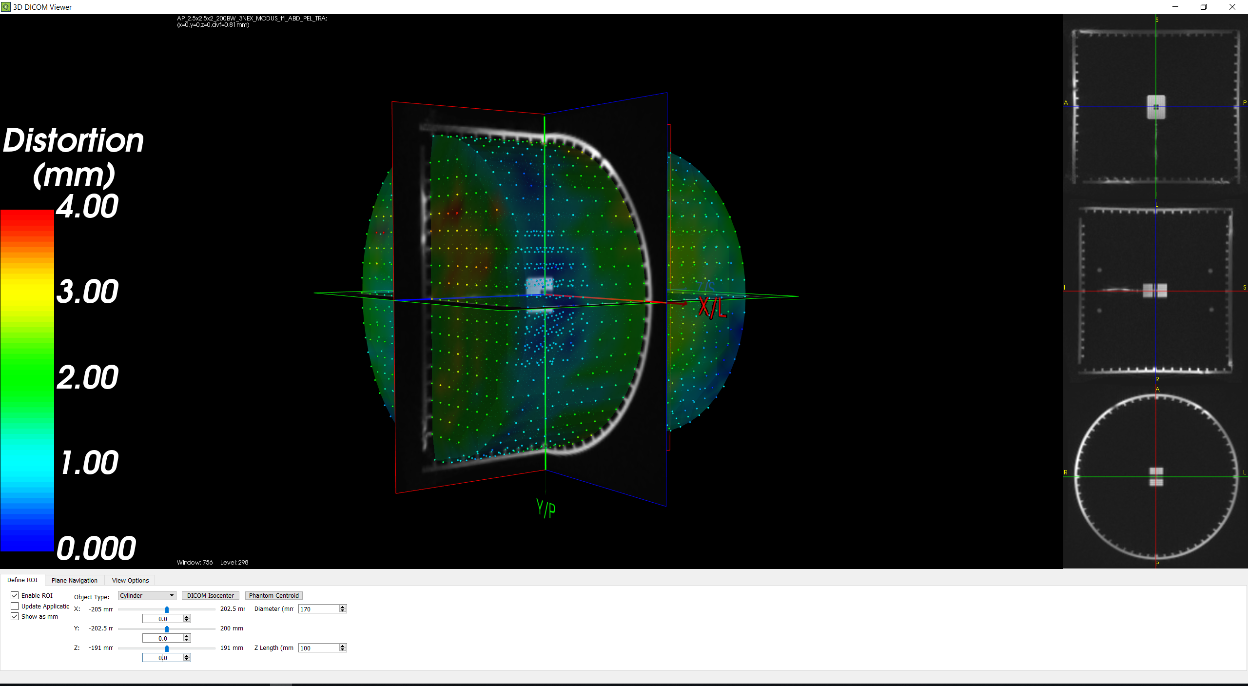 QUASAR™ MRID³ᴰ Geometric Distortion Analysis System - Modus 